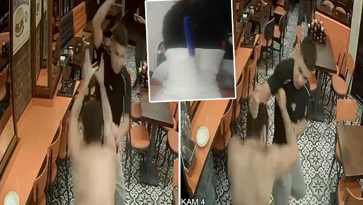 Ensesine saplanan bıçakla hastaneye gitti! Dehşet dolu anlar kamerada