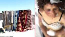 Eşinin kerpetenle tırnaklarını çeken caniye istenen ceza netleşti