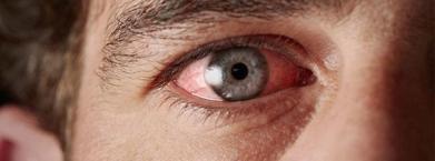 'Kırmızı göz' hastalığına dikkat!