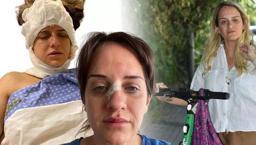 Skuter kazalarında ciddi artış! 5 dakikalık yolculuk için 7 ay tedavi gördü