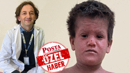 Türkiye'deki bir evlilik geleneği neden oluyor! İşte Türk doktorun keşfettiği hastalık