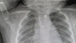 Bebeğine nazar boncuğu takanlar dikkat! Uzmanı uyardı: Yutma riski oluşabilir