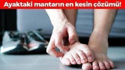 Ayak mantarının kökünü kurutuyor! Egzama, mantar ve kuruluğa iyi geliyor, cildi neme doyurup 5 dakikada ayakları bebek gibi yumuşacık yapıyor!