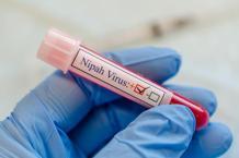Nipah virüsü nedir, nasıl bulaşır, Türkiye'de var mı? Nipah virüsü belirtileri nelerdir, nasıl ortaya çıkar?