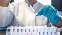 Evde temizlik yaparken gerçeği öğrendi! HIV pozitif olduğunu eşinden saklamıştı, cezası belli oldu