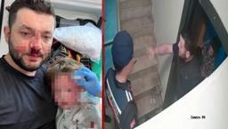 Türkiye'nin konuştuğu olay! Baba ile 14 aylık bebeği darbedilmişti: Yeni görüntüler ortaya çıktı