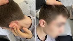 Ekmek almaya giden 14 yaşındaki çocuğu 'hırsız' diye öldüresiye dövdüler