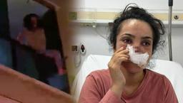 Kocası tarafından burnu ısırılıp koparılan İmran konuştu: 'Balkondan atlamayı düşündüm'