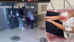 Kapı kolu atardamarını kesti! 12 yaşındaki Asya okulda ölümden döndü