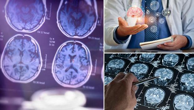 Sadece 13 kişide görüldü! Nadir hastalıklara bir yenisi eklendi)