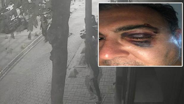 Bakırköy’de kedi besleyen iş insanına ‘yolu kapattın’ dayağı)