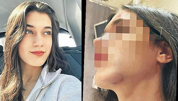 Eski sevgili dehşeti)