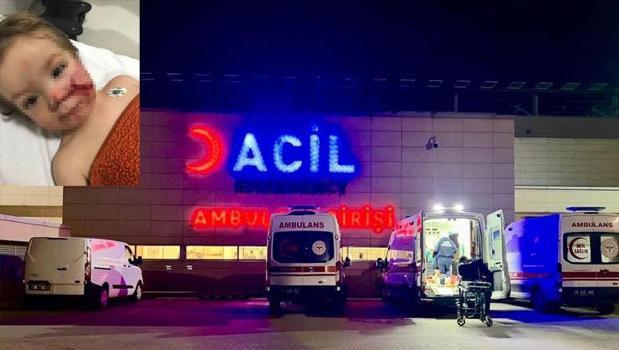 Pitbull dehşeti: Küçük çocuğun yüzü paramparça oldu)