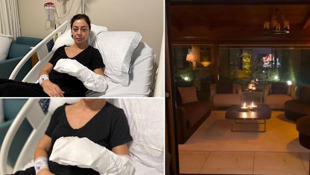 Dekoratif şömine bomba gibi patladı! Vücudunun yüzde 30'u yandı: İsler 4. kata kadar ulaştı)