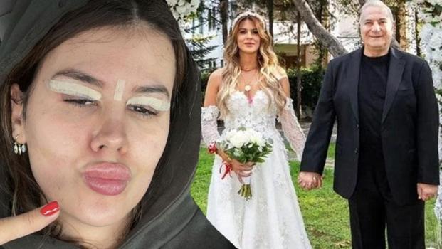 Mehmet Ali Erbil'in kendisinden 40 yaş küçük eşi Gülseren Ceylan göz kapağını aldırdı)