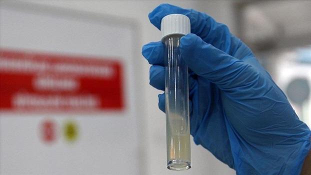 DSÖ’den çarpıcı uyarı: Tüberküloz her yıl bir milyon can alıyor)