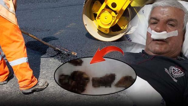 Yılların tozu ve çimentosu burnunda taşa dönüştü! 27 yıl sonra şoke eden gerçek)