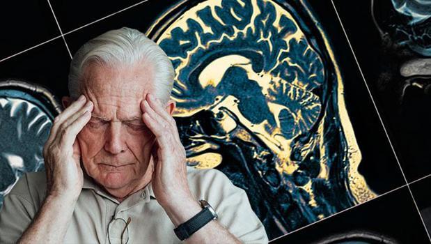 Erkeklerde demansı yüzde 60 oranında azaltabilir! 35 yıl önce başlatılan çalışma)