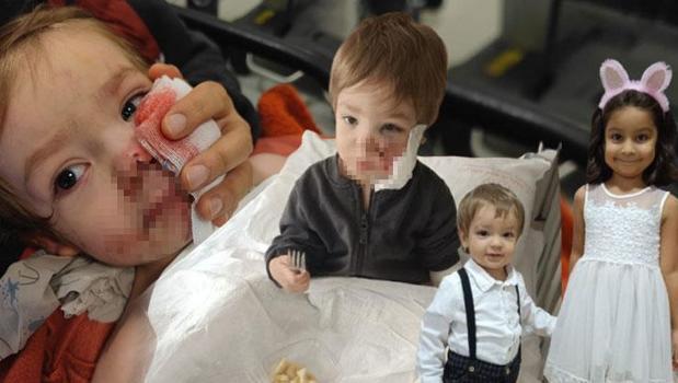 2 kardeşe saldırıp hastanelik etti! Pitbullun sahibinden pişkin savunma)