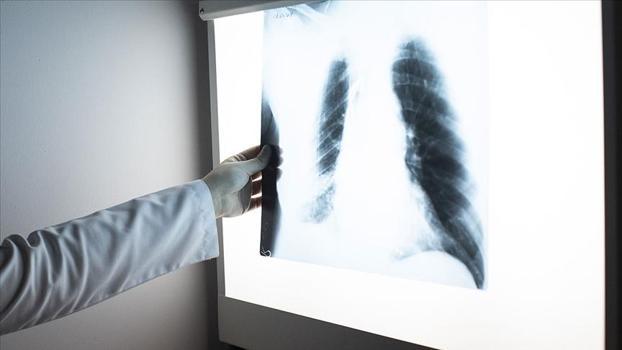 Her 100 kişiden birinde görülüyor! Ölüm oranı çok yüksek)