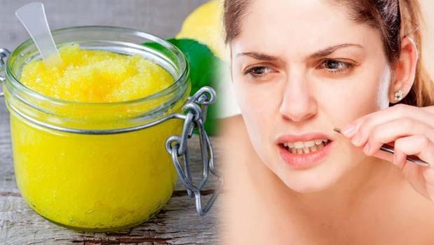 Tüylerin kökünü kurutuyor! Ne jilet ne epilasyon: Evde bulunan 2 malzemeyi kullanmak yeterli!)