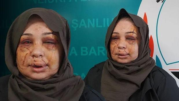 Ankara'da eşine dehşeti yaşatan polis tutuklandı! Bakanlardan peş peşe açıklama)