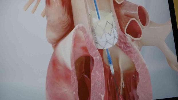 Genç yaştaki ani ölümlerde korkutan gerçek: Yüzde 90’ı bu sebepten kaynaklanıyor)