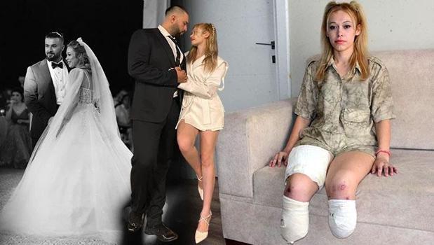 Evlilik yıldönümünde gelen kabus: İki bacağını birden kaybetmişti, kararı duyunca yıkıldı!)