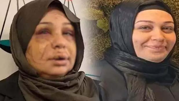 Jiletli saldırıya ağır ceza yolu)