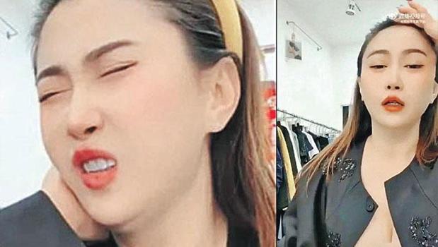 Fenomen canlı yayında beyin kanaması geçirdi)