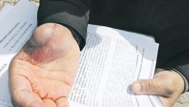 İhmal zinciri parmaksız bıraktı)