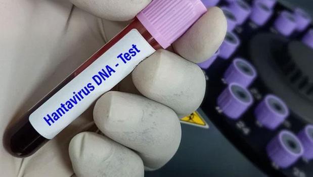 DSÖ'den hantavirüs açıklaması: Vaka sayısı artabilir)