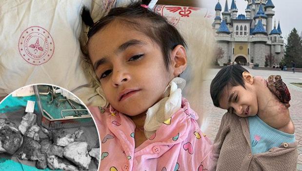 8 yaşındaki Fatma'nın boynundan çıkanlar tıp tarihine geçti! 'Bize masada kalır dediler')