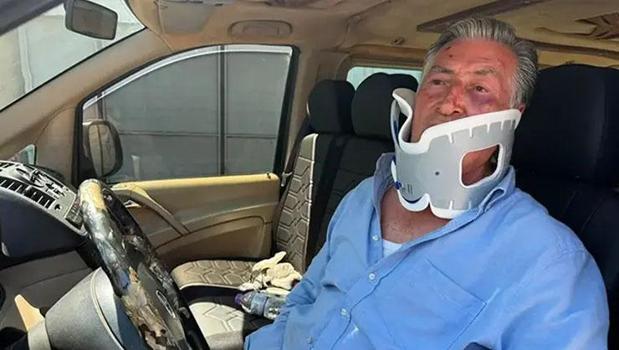 Antalya'da tur şoförü Litvanyalı boksör tarafından hastanelik edildi: 'Telefonu şarja koymadın diye yumrukladı')