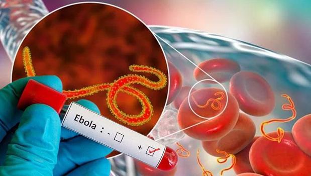 DSÖ'den acil toplantı: 'Ebola virüsünün yayılma hızı endişe verici' 130 can aldı!)