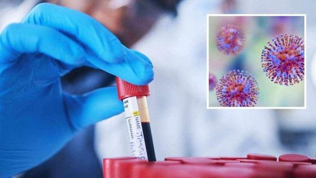 Laboratuvardan kaçırdılar! 113 adet tüpte virüs ve insan DNA'sı: 'Kendilerini kanundan üstün gördüler')