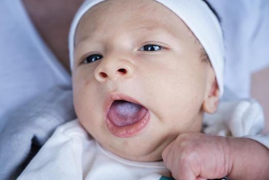 Bebeklerin ağzındaki pamukçuk nasıl temizlenir?)