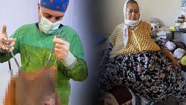 67 yaşındaki kadının karnından tam 40 kilogram kitle çıktı)