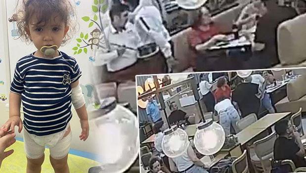 Restoranda sunum kazası! Tava sapı bir anda koptu, küçük Mercan'ın üzerine kızgın yağ döküldü)