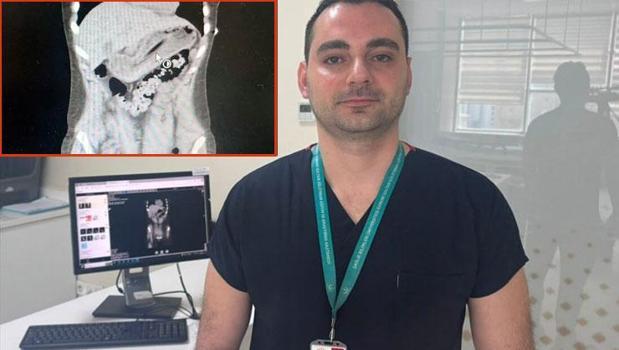 Zayıflamak uğruna kendine yaptığına doktorlar bile inanamadı!)