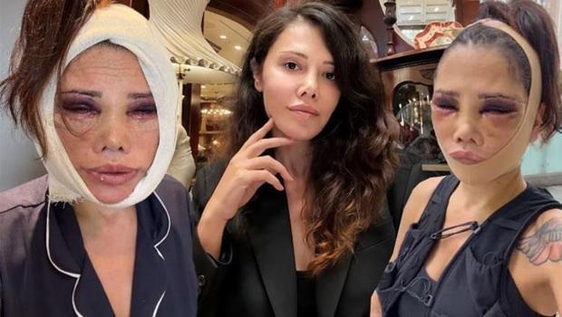 İki kez yüzünü gerdiren Didem Ceran'dan estetik açıklaması! 'Kim Kardashian yöntemleri uygulanacak')
