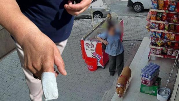 Parmağını koparan pitbullun sahibine şiir yazdı! 'Bre gafil, neden takmadın köpeğine ağızlık?')