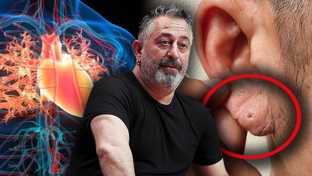 Kulak memesindeki o çizgi ne anlama geliyor? Cem Yılmaz'ın rahatsızlığı sonrası uzmanlardan kritik uyarı!)