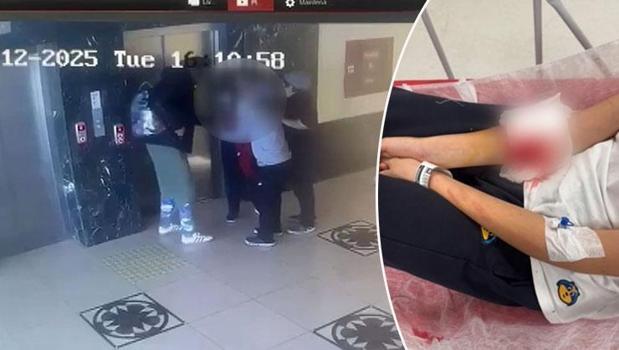 Kapı kolu atardamarını kesti! 12 yaşındaki Asya okulda ölümden döndü)