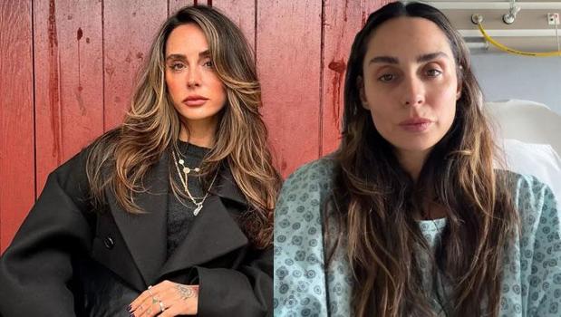 Yasemin Yürük dün ameliyat oldu! Çıkarılan vidalar korkuttu)
