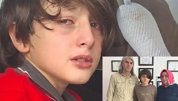 Oyuncak elinde patlayan çocuk, 2'nci derece yandı! 'Hakkımızı sonuna kadar arayacağız')
