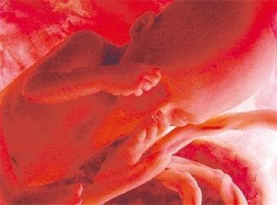 Bir de şu bulantılar olmasa (5)