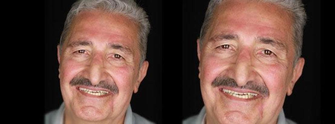 Yaşar Güner hayatını kaybetti