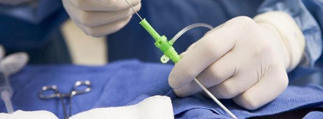 Girişimsel radyoloji her hastalığa deva oluyor