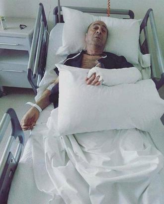 Levent Oran ev kazası geçirdi, hastanelik oldu